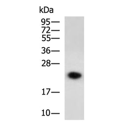 LCN2 rabbit polyclonal antibody
