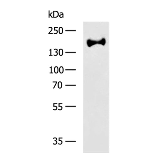 RTN4 rabbit polyclonal antibody