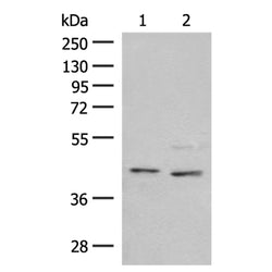 NPY1R rabbit polyclonal antibody