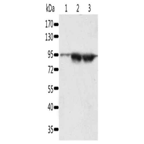 SPATA20 rabbit polyclonal antibody