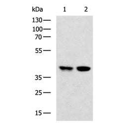 S1PR4 rabbit polyclonal antibody