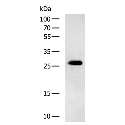 SLC25A4 rabbit polyclonal antibody