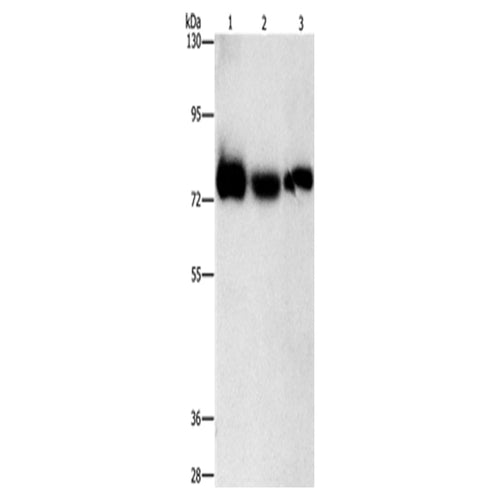 AMPD1 rabbit polyclonal antibody