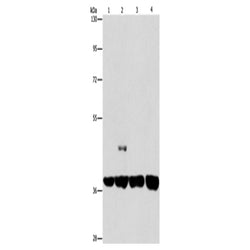 SERPINA9 rabbit polyclonal antibody