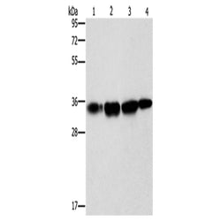 NSMCE3 rabbit polyclonal antibody