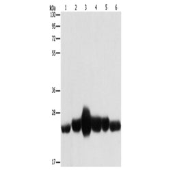CAV1 rabbit polyclonal antibody