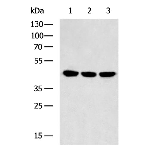 ACTA2 rabbit polyclonal antibody