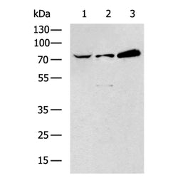 ALOX15 rabbit polyclonal antibody