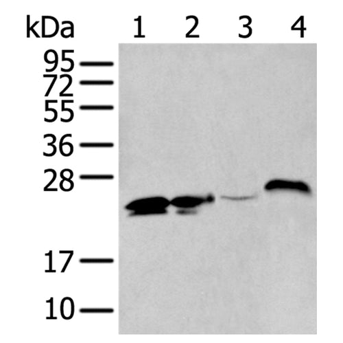 BCAS4 rabbit polyclonal antibody