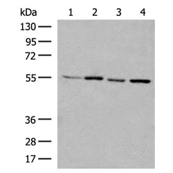 CCR6 rabbit polyclonal antibody