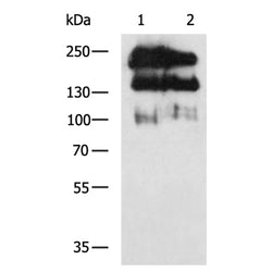 NCAM1 rabbit polyclonal antibody