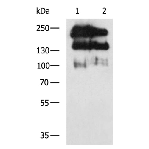 NCAM1 rabbit polyclonal antibody