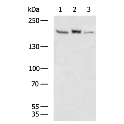 CLTC rabbit polyclonal antibody