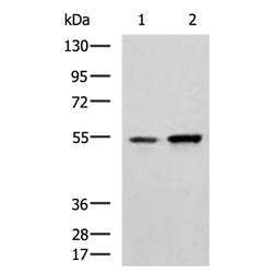 CALCRL rabbit polyclonal antibody