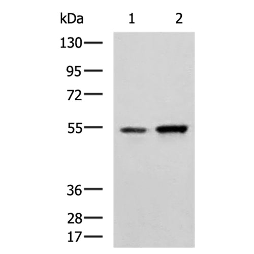 CALCRL rabbit polyclonal antibody
