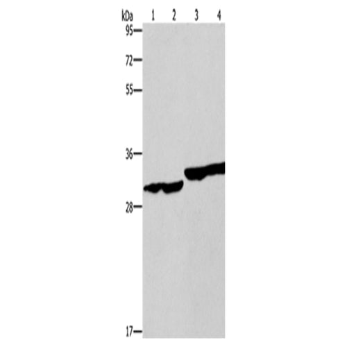 DECR1 rabbit polyclonal antibody