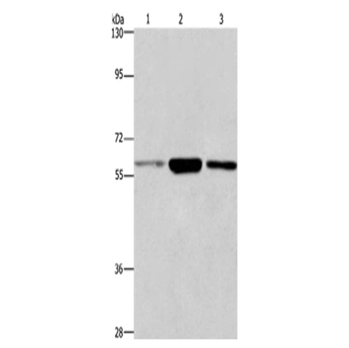 GPC6 rabbit polyclonal antibody