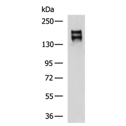 ADGRA2 rabbit polyclonal antibody