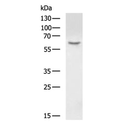 HAS1 rabbit polyclonal antibody
