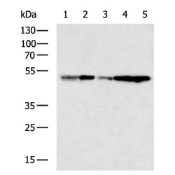 HNRNPH1 rabbit polyclonal antibody
