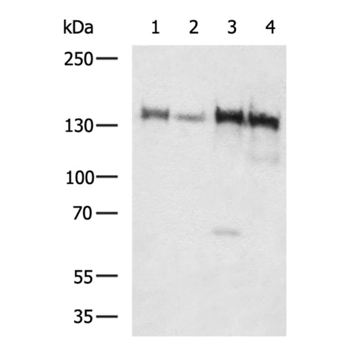 ITGA11 rabbit polyclonal antibody