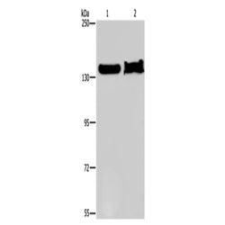 KDM4A rabbit polyclonal antibody