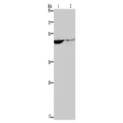 KCNK9 rabbit polyclonal antibody
