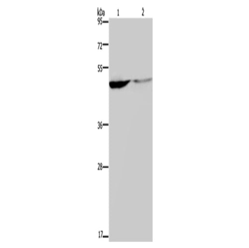 KCNK9 rabbit polyclonal antibody