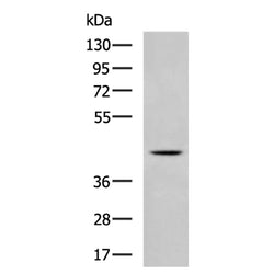 CERS1 rabbit polyclonal antibody