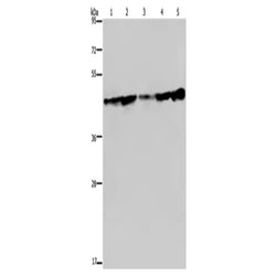 CERS4 rabbit polyclonal antibody