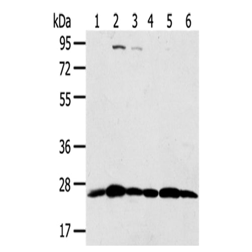 PSMB8 rabbit polyclonal antibody