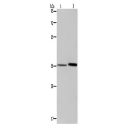 MAGEF1 rabbit polyclonal antibody