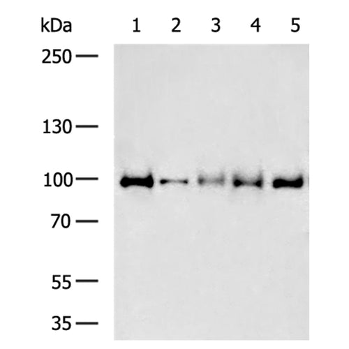 MAP3K11 rabbit polyclonal antibody