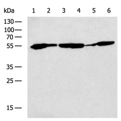 MMP20 rabbit polyclonal antibody