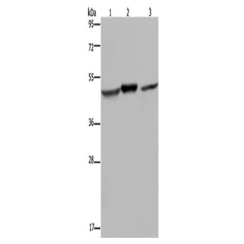 NDUFS2 rabbit polyclonal antibody