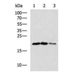TNFRSF13C rabbit polyclonal antibody