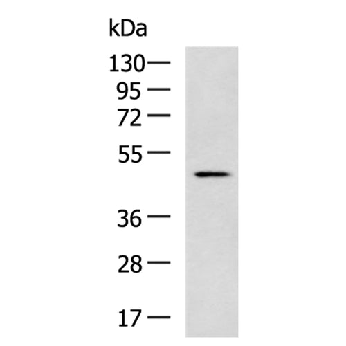 MYCN rabbit polyclonal antibody