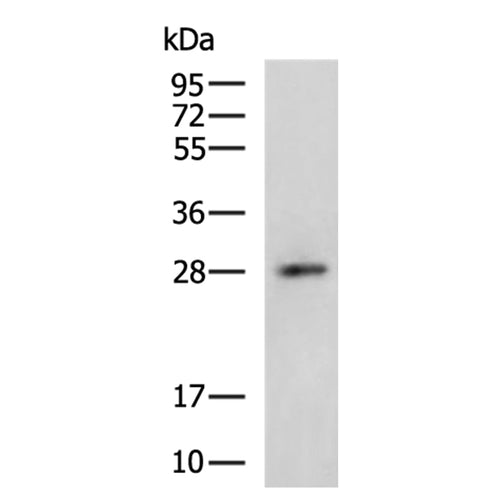OSM rabbit polyclonal antibody