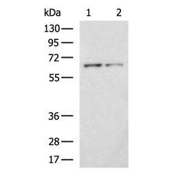 IVL rabbit polyclonal antibody