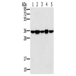 PPP1CC rabbit polyclonal antibody