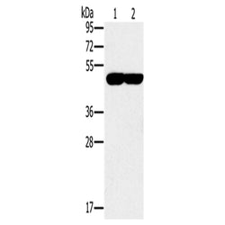 PPOX rabbit polyclonal antibody