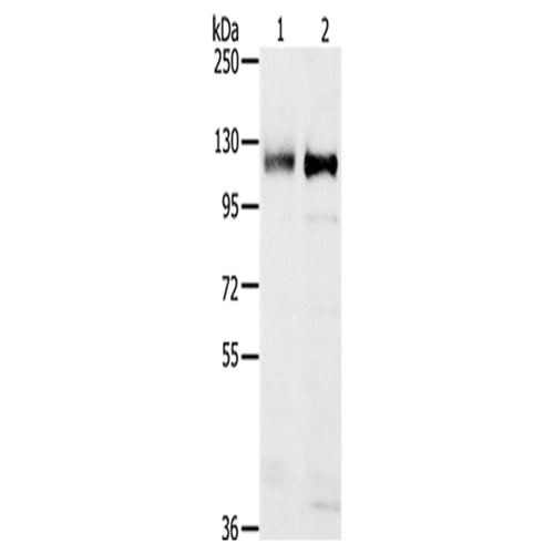 PTPN12 rabbit polyclonal antibody