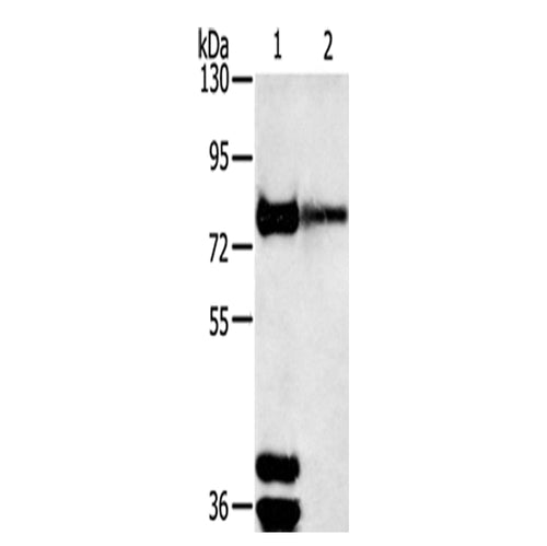 TRIM3 rabbit polyclonal antibody