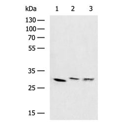 SDHB rabbit polyclonal antibody