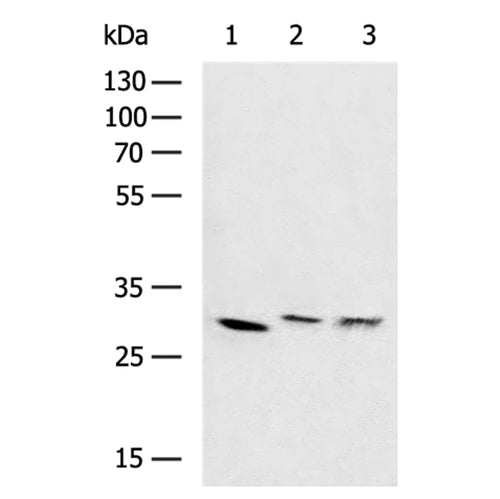 SDHB rabbit polyclonal antibody