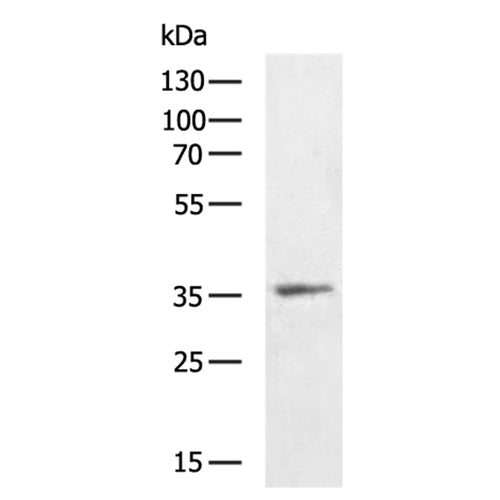 SIGLEC15 rabbit polyclonal antibody