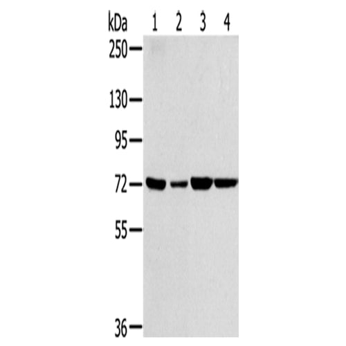SNX2 rabbit polyclonal antibody