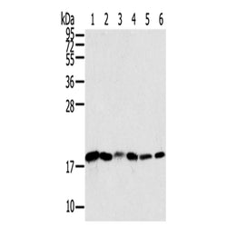 SNX3 rabbit polyclonal antibody
