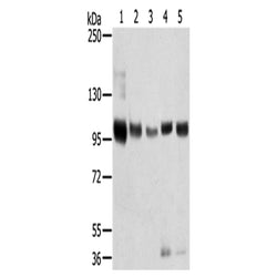 SORT1 rabbit polyclonal antibody