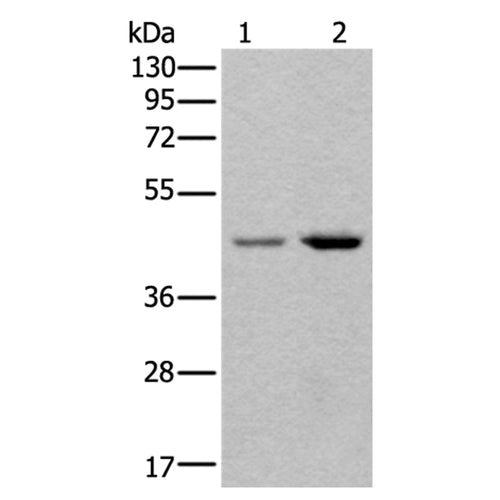 TBX1 rabbit polyclonal antibody